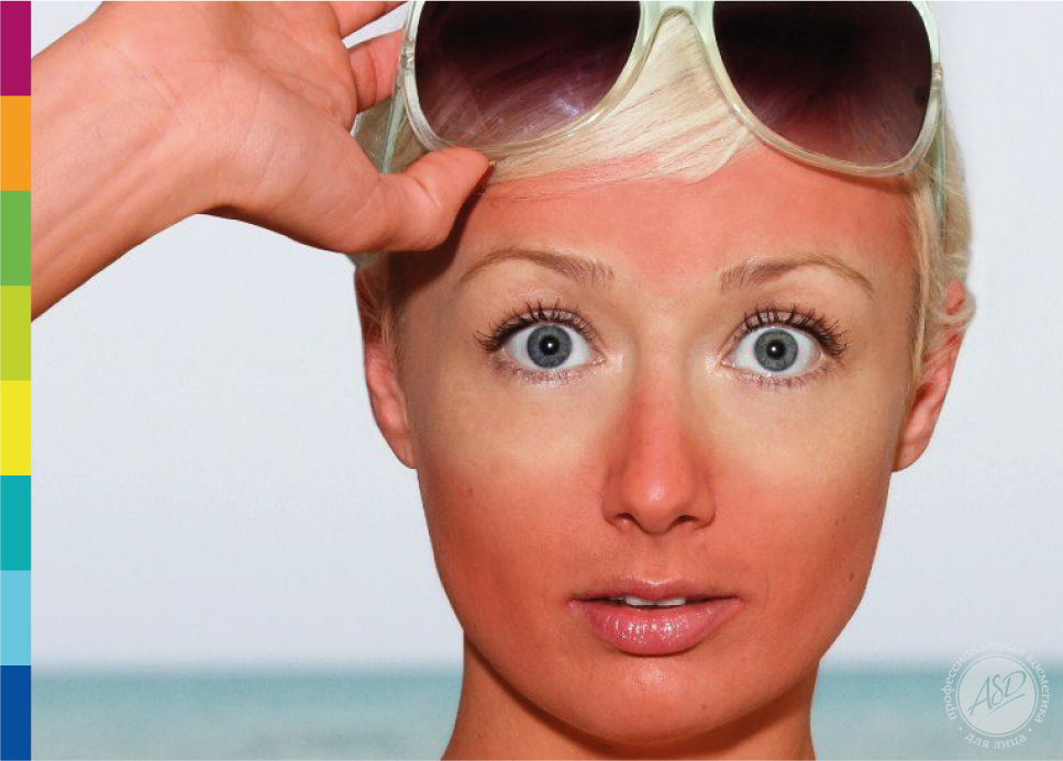 Раздражение кожи на лице: причины и способы лечения | Christina Cosmetics